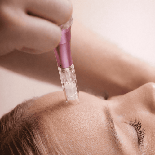 Derma Expert Microneedling Pen