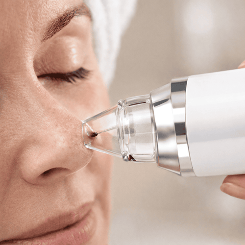 Blackhead Remover med kamera