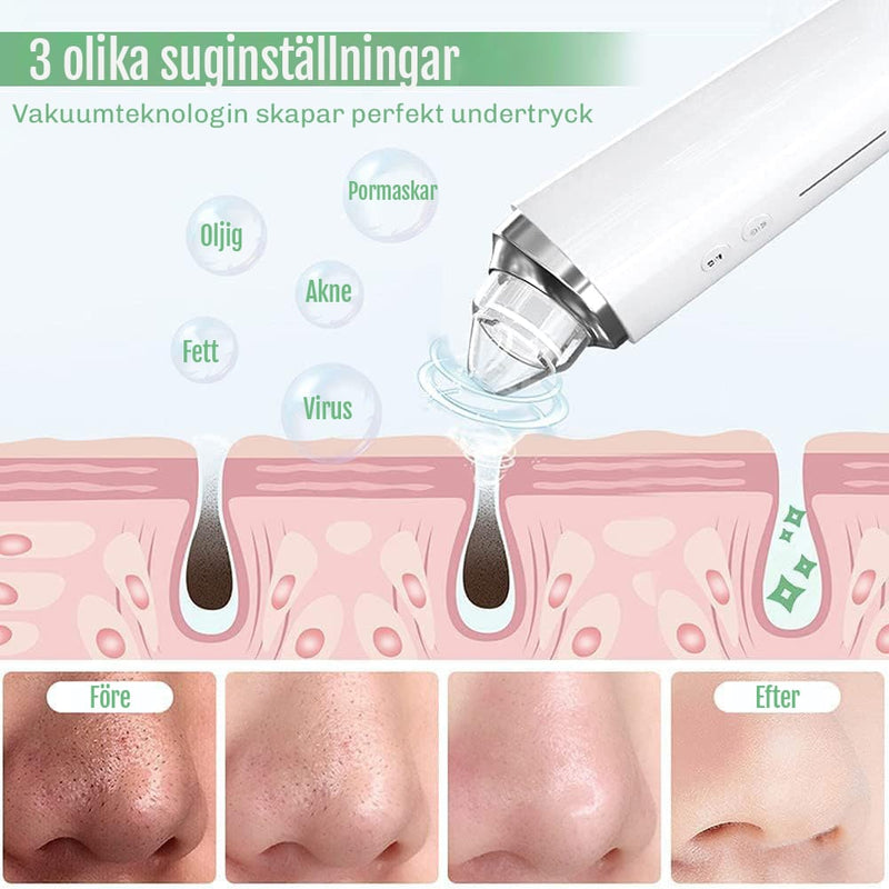 Blackhead Remover med kamera