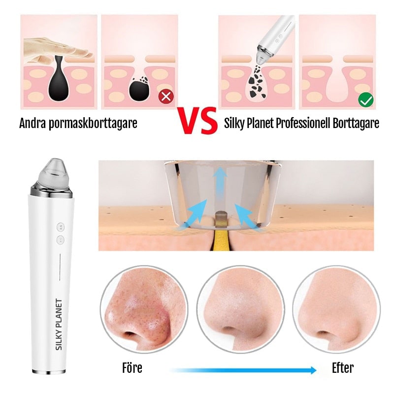 Blackhead Remover med kamera