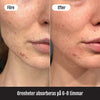 Pimple Patches