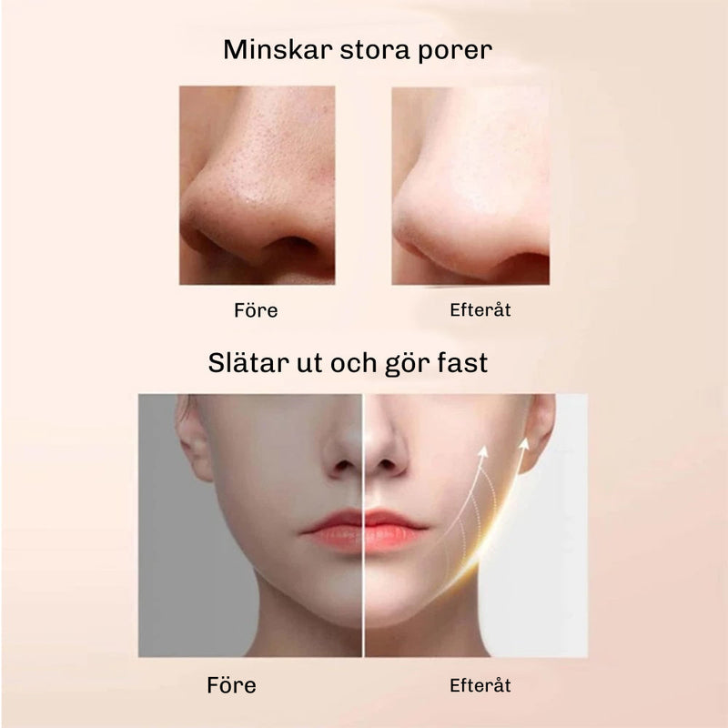 DermaGlow 5 – professionell ultraljudspeeling för hemmabruk.