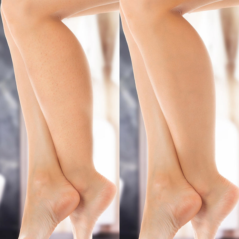 Del av din skönhetsrutin: Silky Planet IPL Lumi för permanent hårreduktion hemma