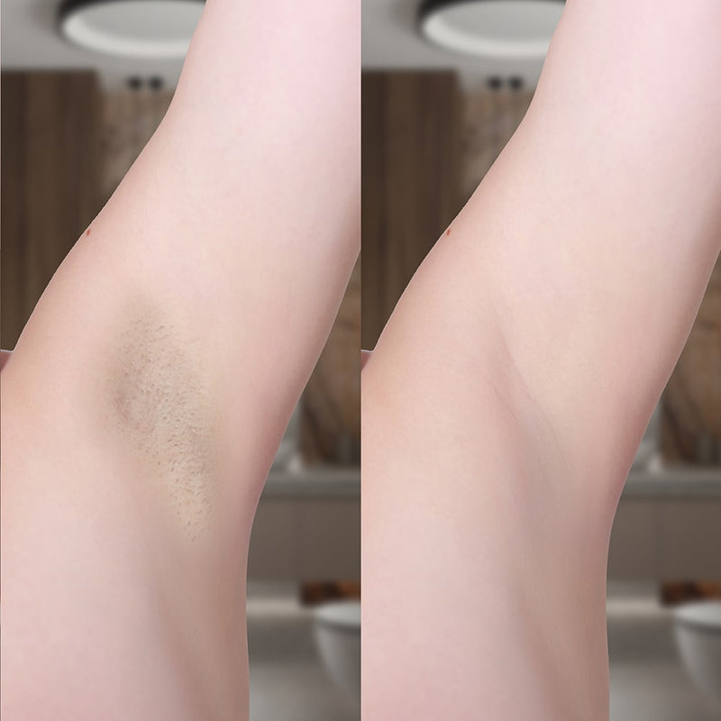 Lämplig för flera hår- och hudtyper – skonsam men effektiv teknologi