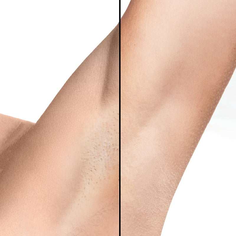 Presentidé: Silky Planet IPL Lumi – perfekt för långvarigt slät hud