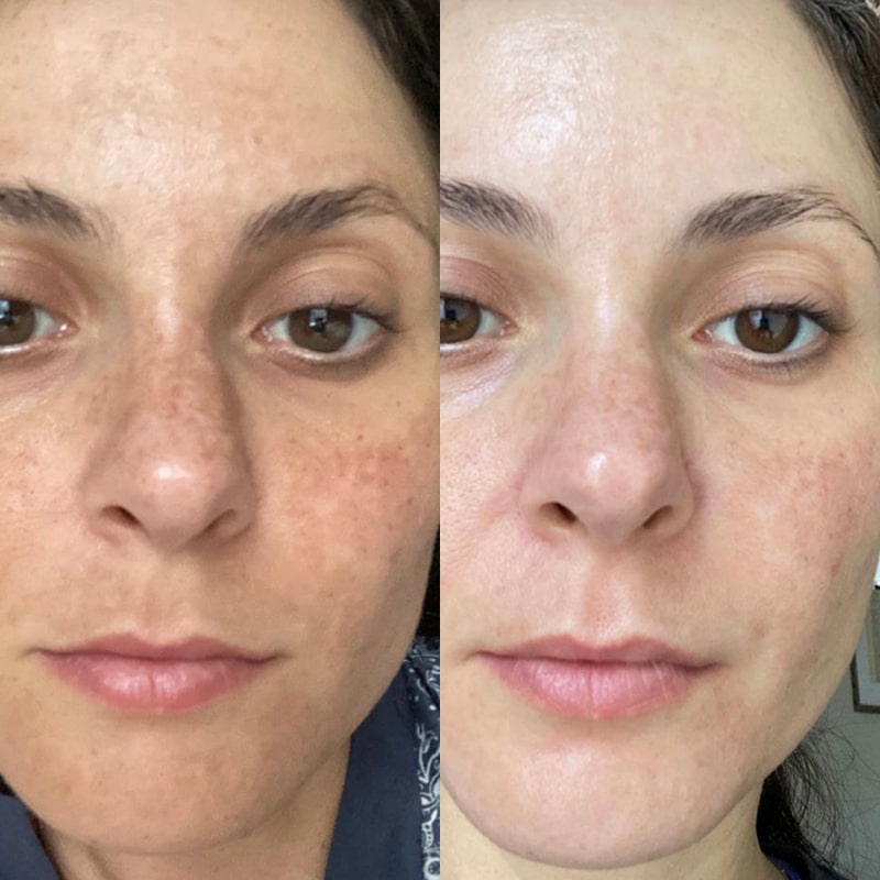 Silky Planet Kollagen Lifting Creme – effektiv anti-age-kräm för fastare hud