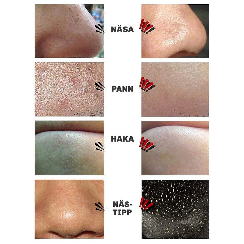 Del av skönhetsrutinen: Silky Planet pormaskmask för ren och klar hud