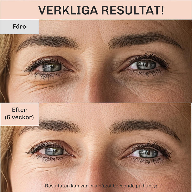 Formulan hjälper till att reducera synligheten av fina linjer och rynkor runt ögonen.