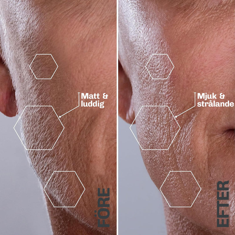 Före-efter jämförelse: hud före och efter användning av ultraljudstekniken